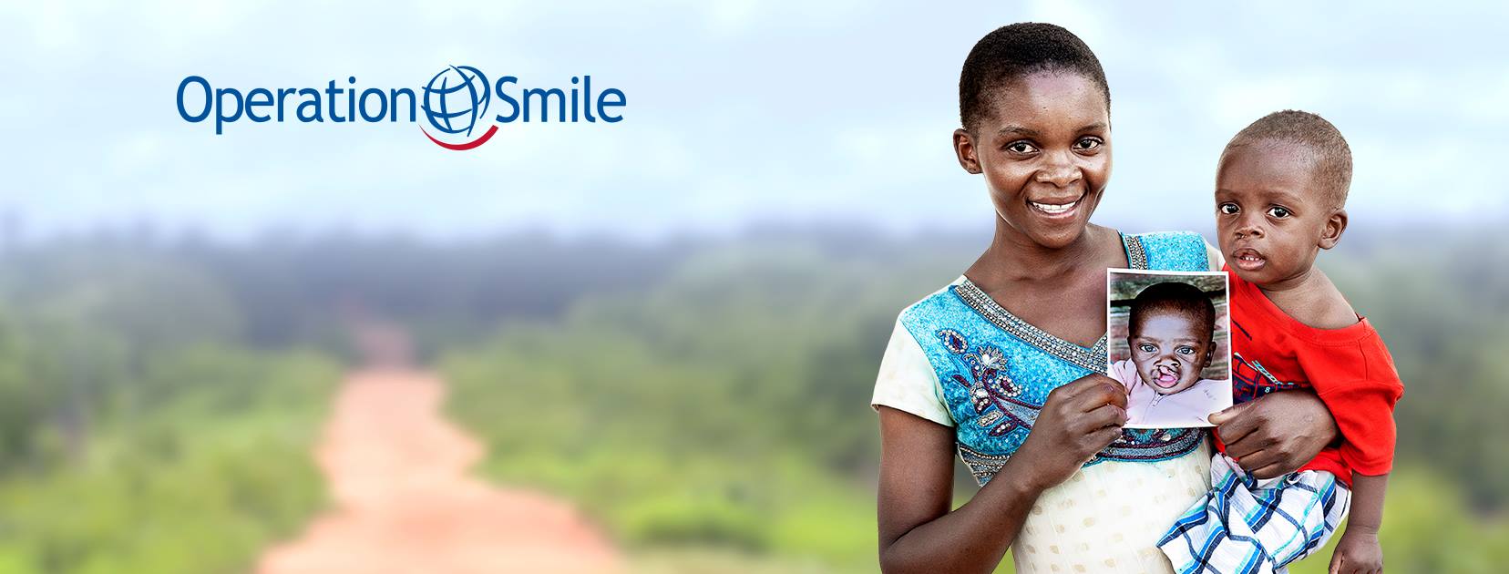 operation smile giornata mondiale per i diritti dell'infanzia